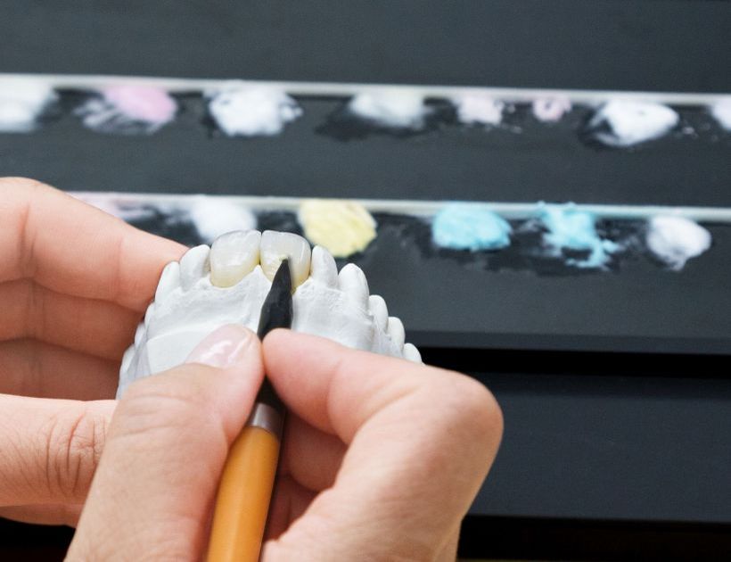 Einsatz neuester Keramikmaterialien für ein natürliches, lichtoptisches Erscheinungsbild, sowie Verwendung von Materialien mit höchster Biokompatibilität